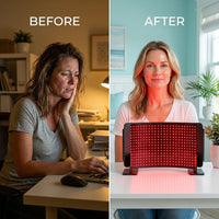 HelioCurve Elite Red/NIR Therapy Panel — Before & After
